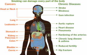 Smoking Can Damage